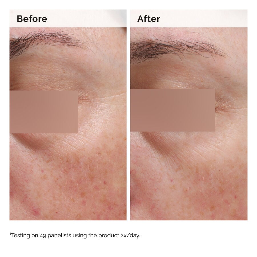 Niacinamide 5% Face and Body Emulsion I6 image 3