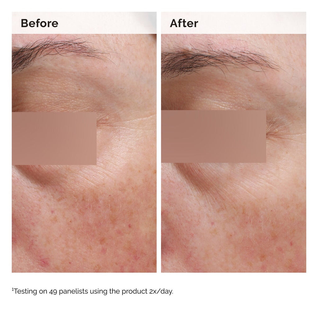 Niacinamide 5% Face and Body Emulsion I6 image 8
