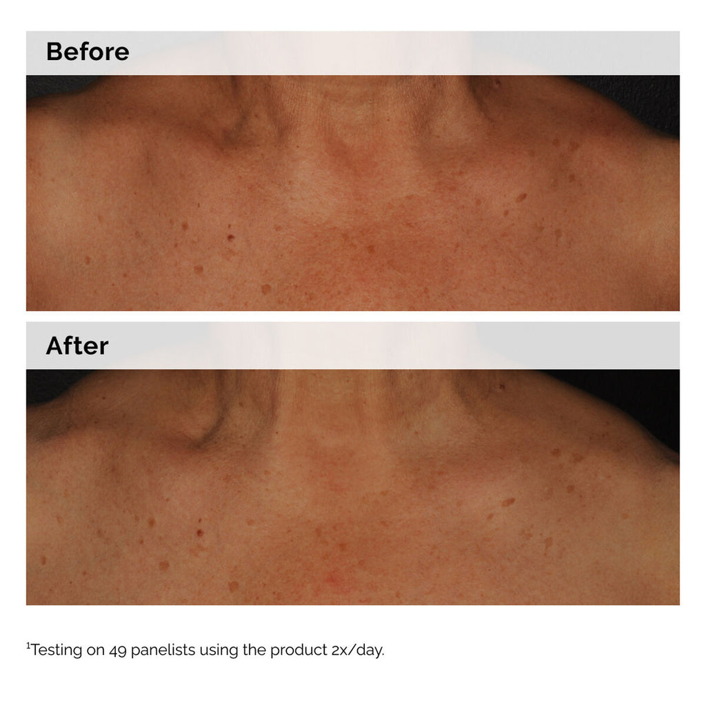 Niacinamide 5% Face and Body Emulsion I6 image 7