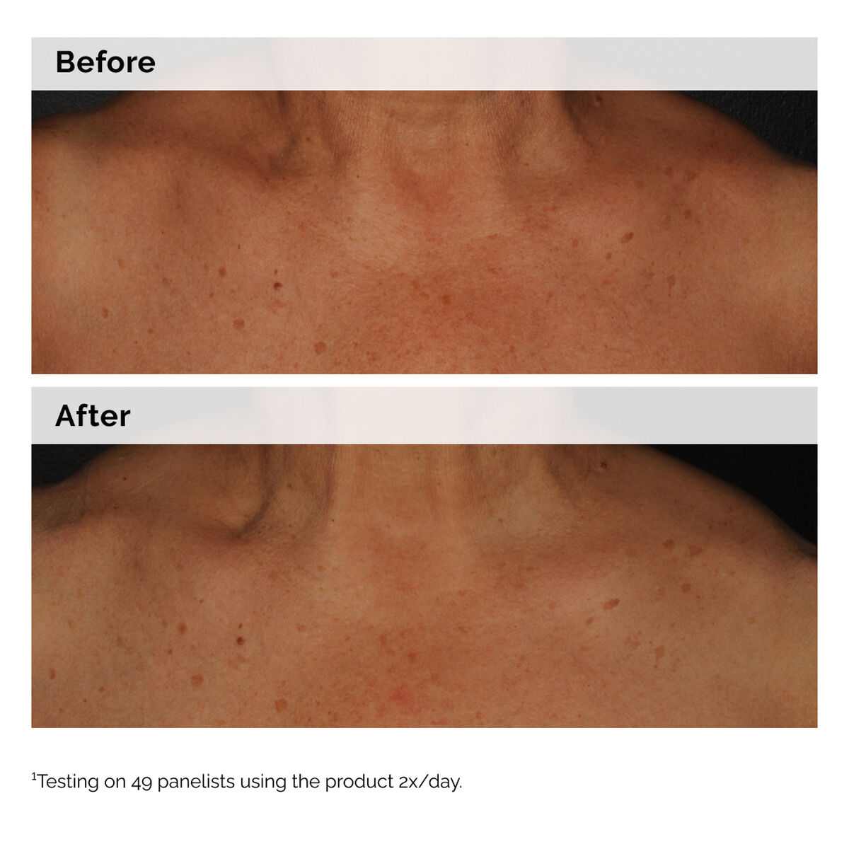 Niacinamide 5% Face and Body Emulsion I6 image 7