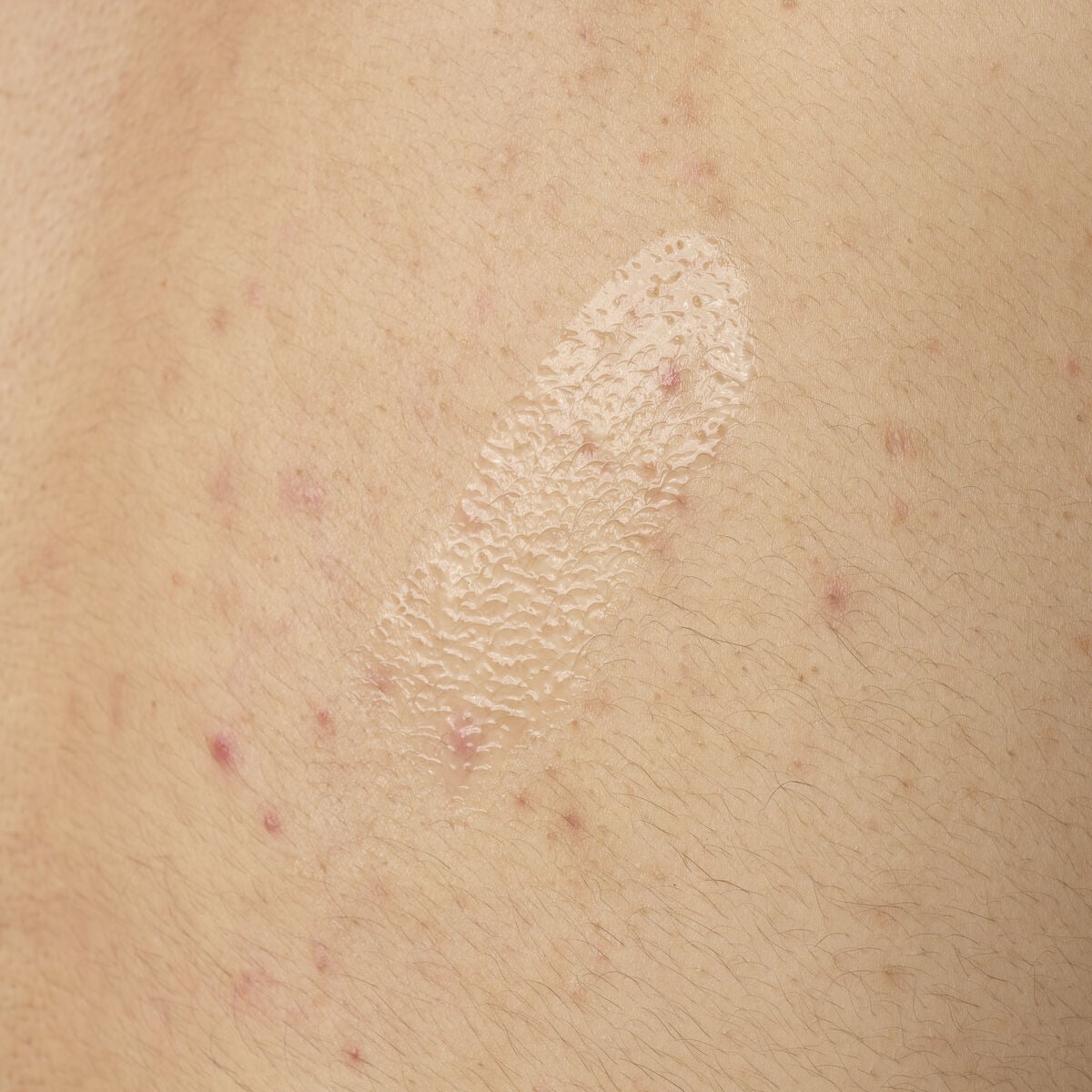 Salicylic Acid 0.5% Body Serum M5 image 8