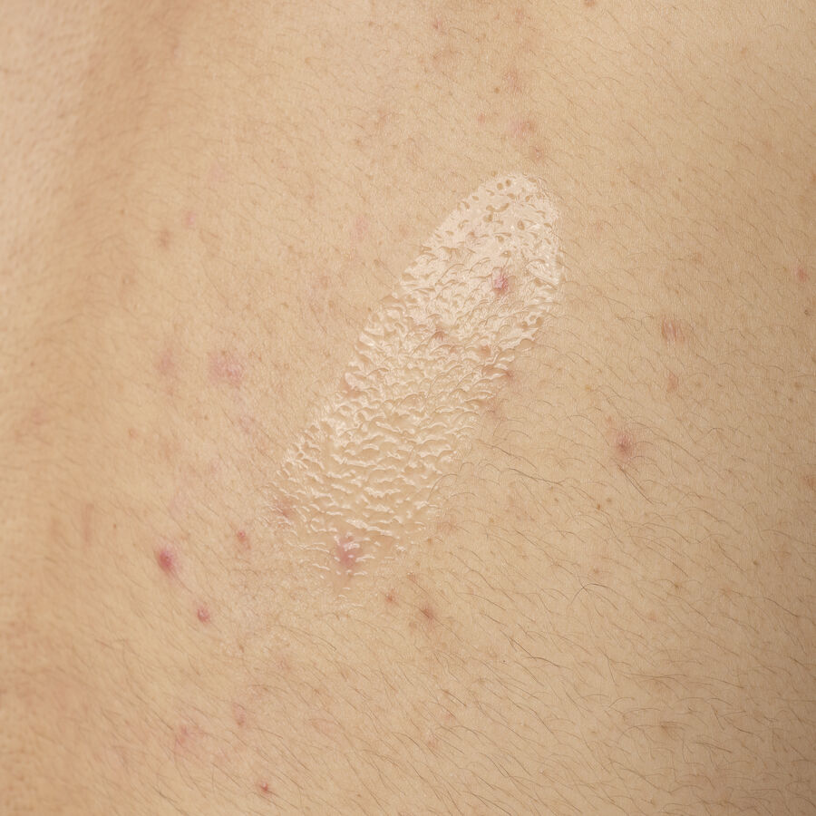 Salicylic Acid 0.5% Body Serum M5 image 4