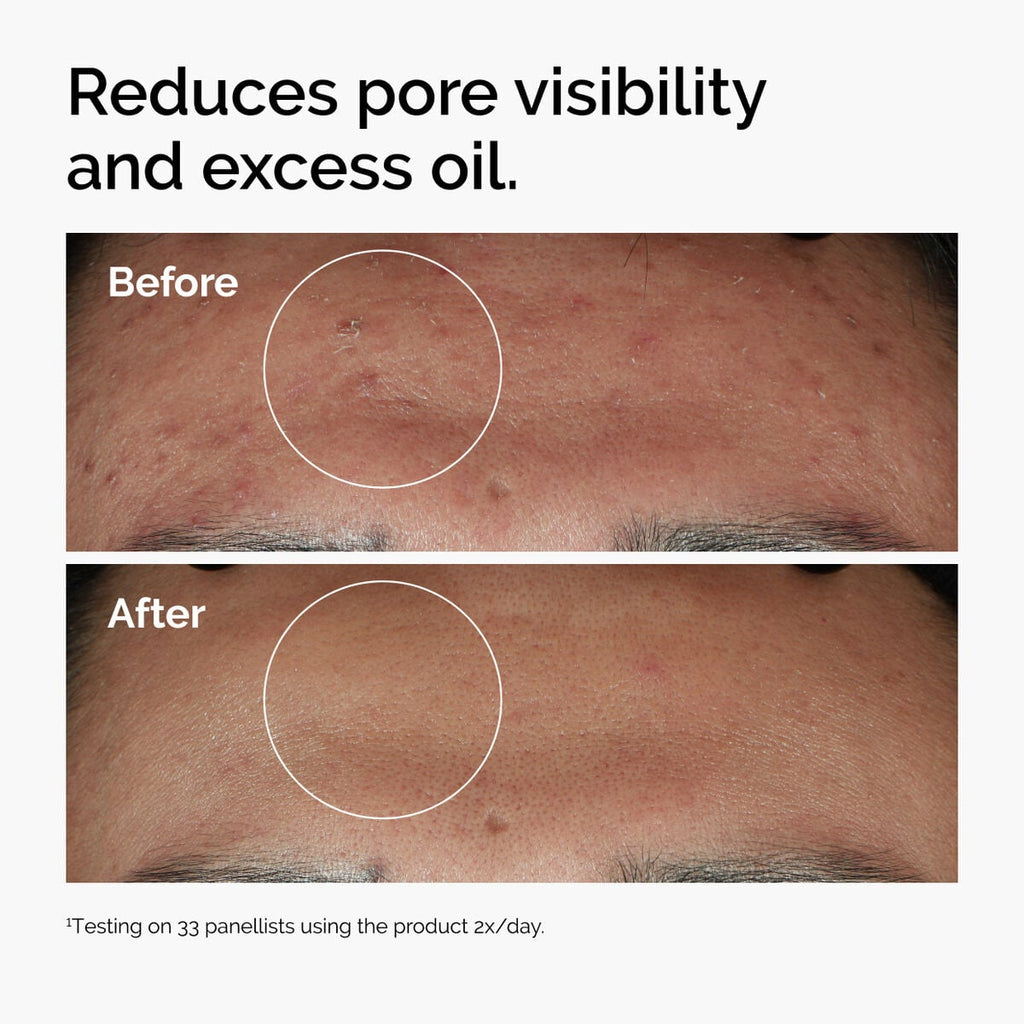 Niacinamide 10% + Zinc 1% F1 image 10