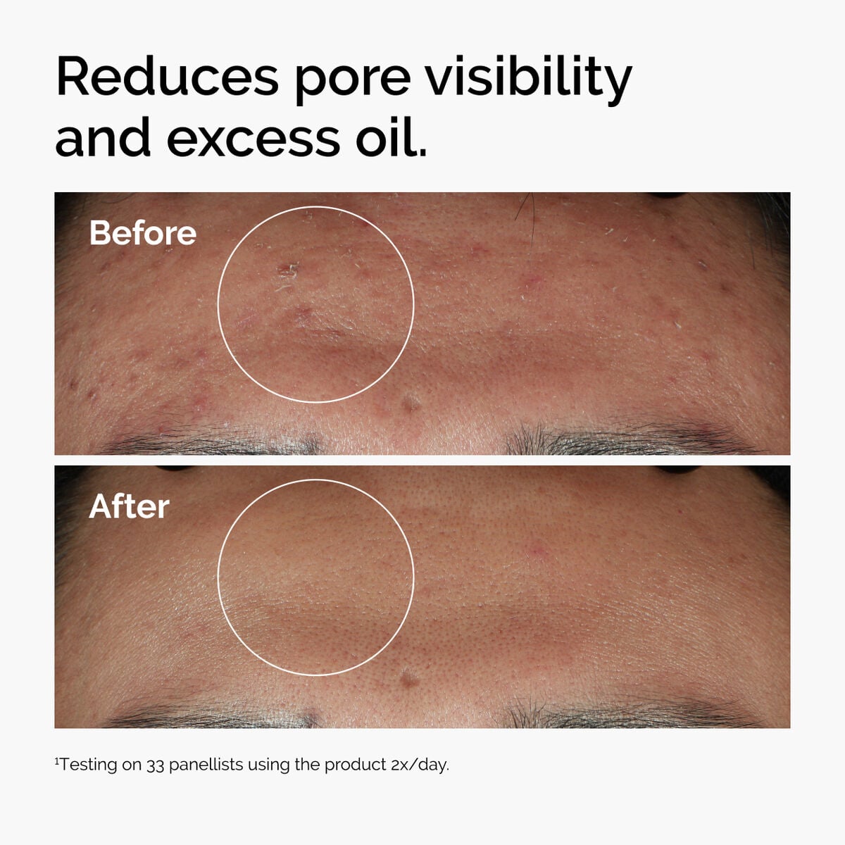 Niacinamide 10% + Zinc 1% F1 image 10