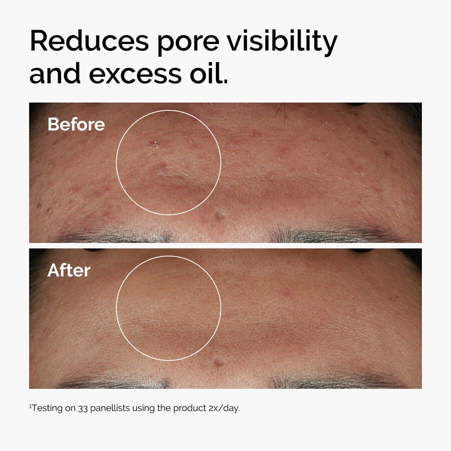 Niacinamide 10% + Zinc 1% F1 image 4