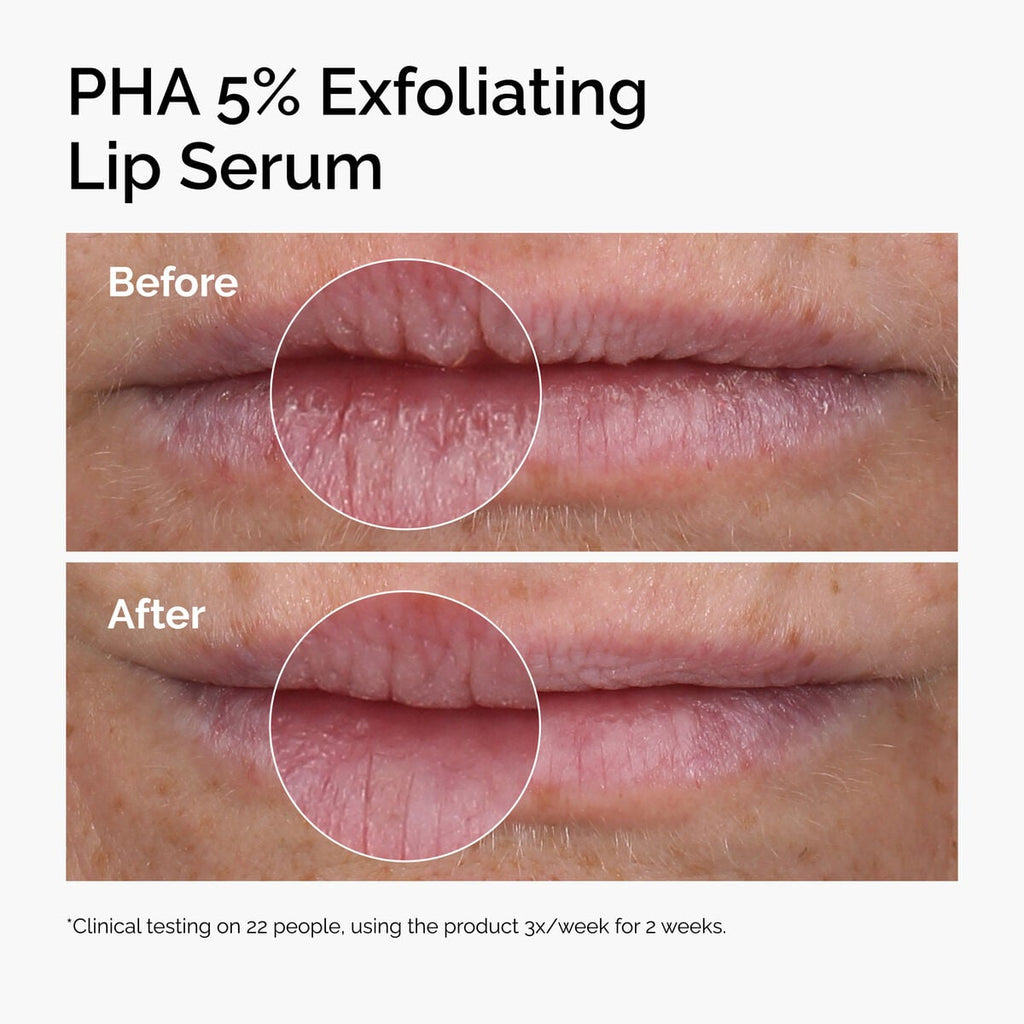 PHA 5% Exfoliating Lip Serum S6 image 9