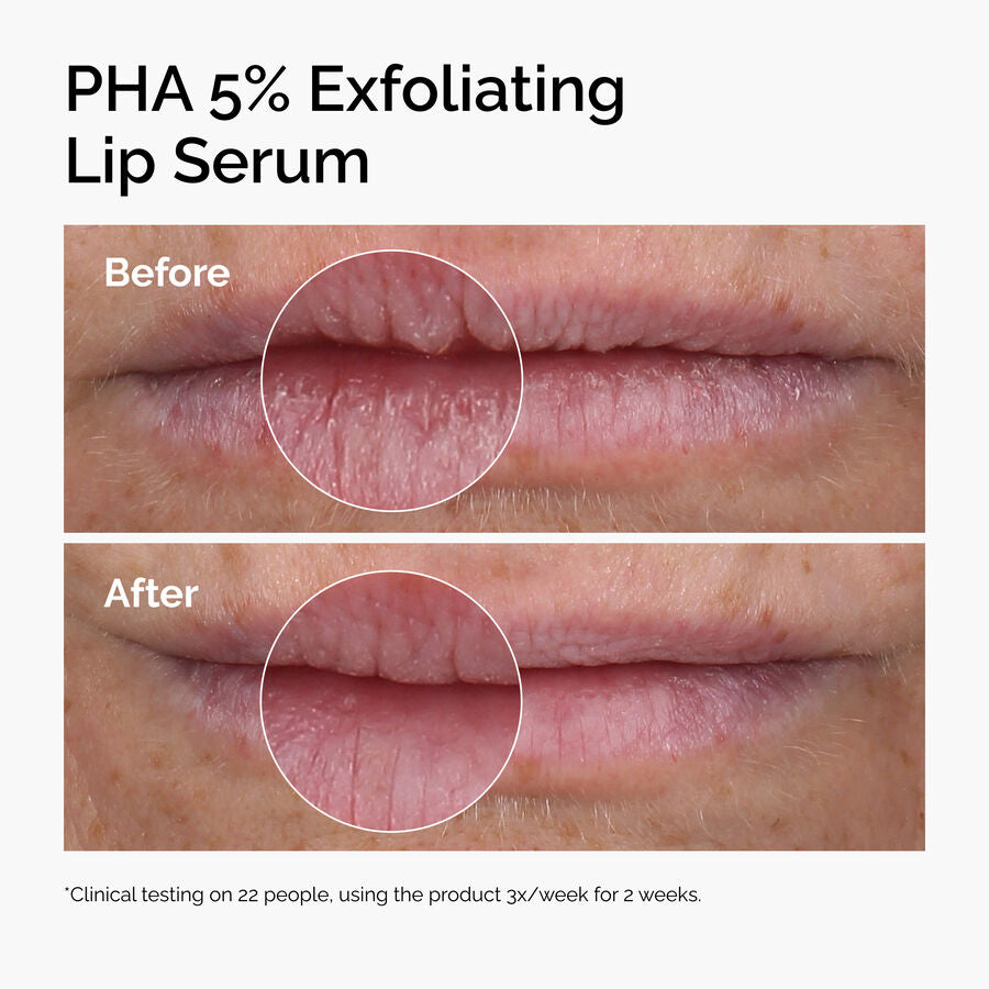 PHA 5% Exfoliating Lip Serum S6 image 3